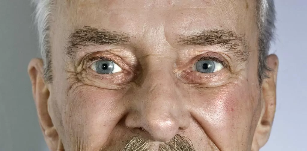 age related eye problems
