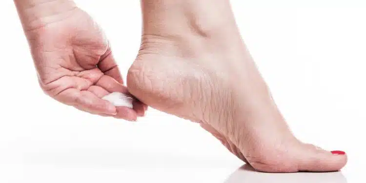 treatment for dry cracked heels
